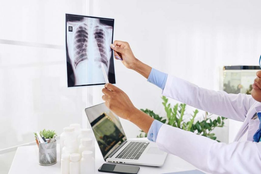 Akciğer Kanserinde Primer Tümöre Bağlı Semptomlar ve Bulgular